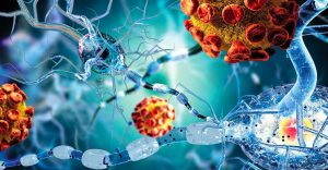 Autoimmune Diseases