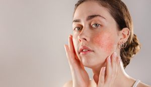 skin_Issues-min