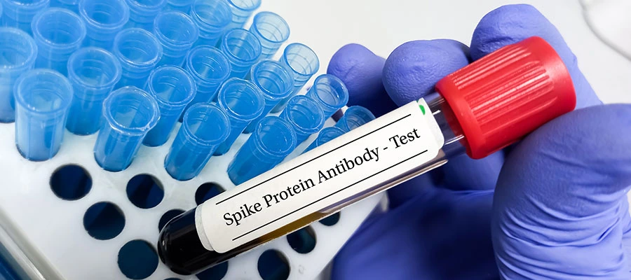 Spike protein antibody test and detox guide for health