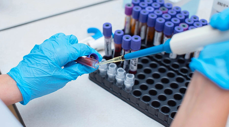 A conceptual diagram showing the interconnected web of gut, immune, and metabolic health.