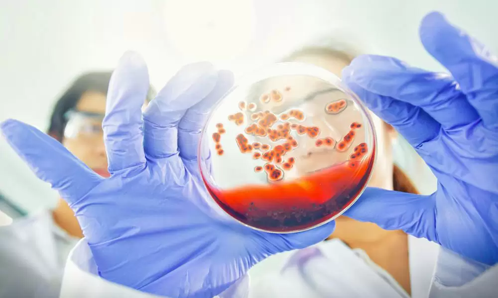 Microbiome-Impacts2